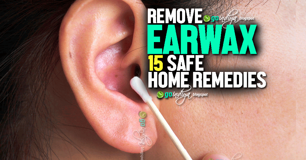 15 Safe Home Remedies to Remove Earwax! Prevent Earwax ...