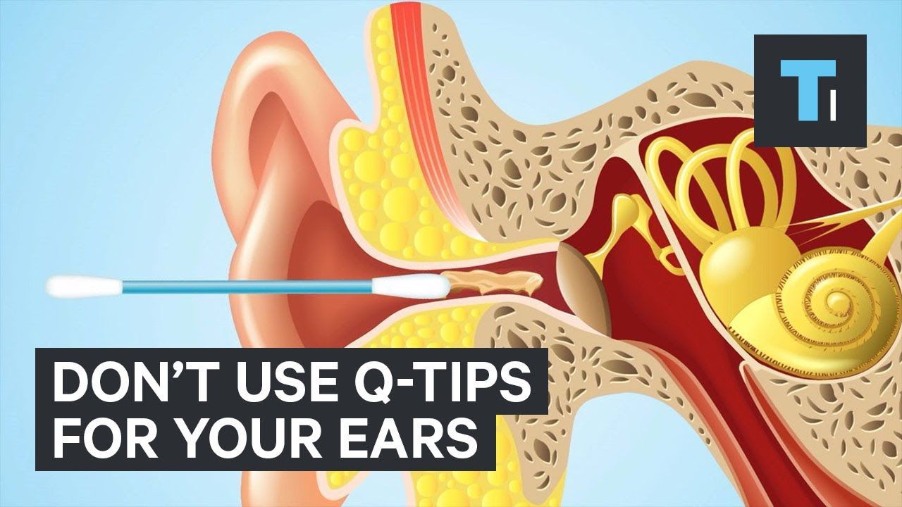 3 Ways To Remove Earwax With No Q