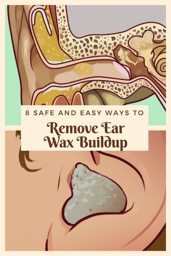 5 Home Remedies To Remove EAR WAX