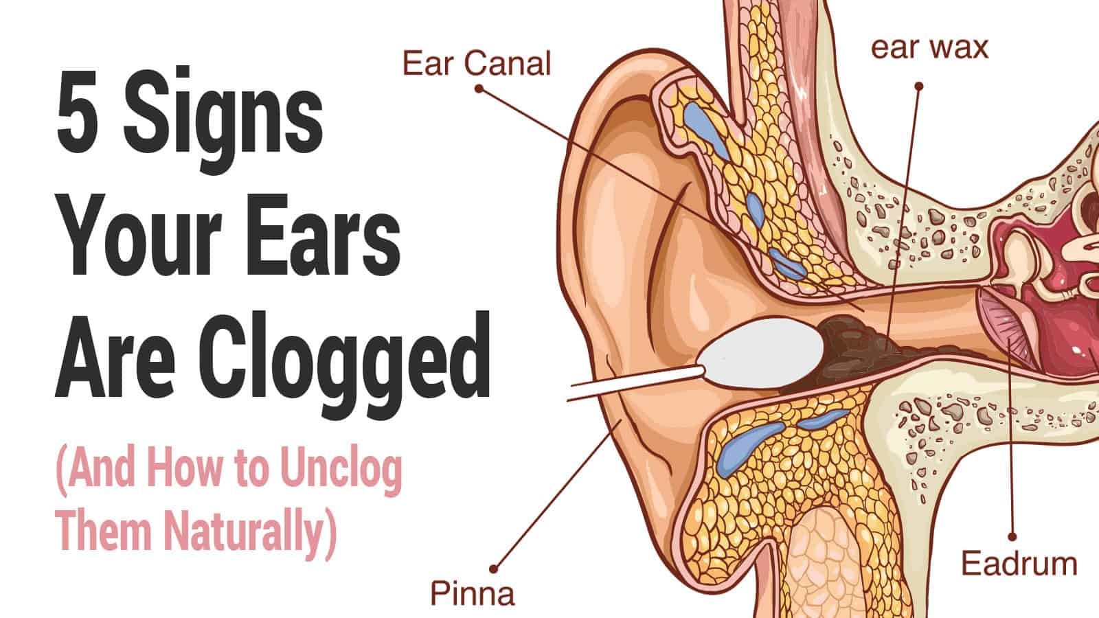 5 Signs Your Ears Are Clogged (And How to Unclog Them ...