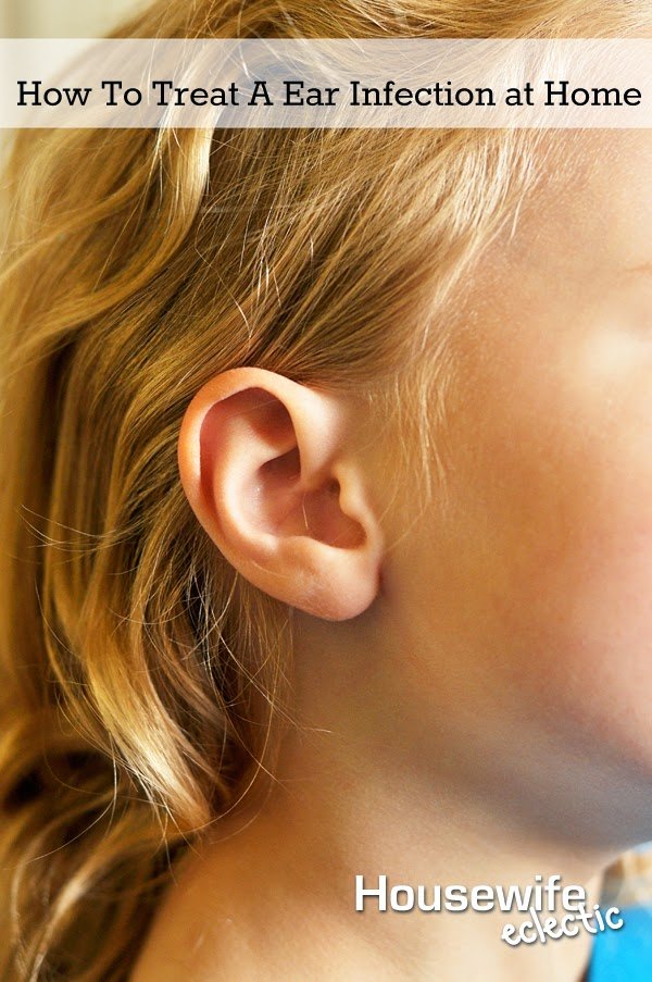 5 Ways to Treat Ear Infections at Home