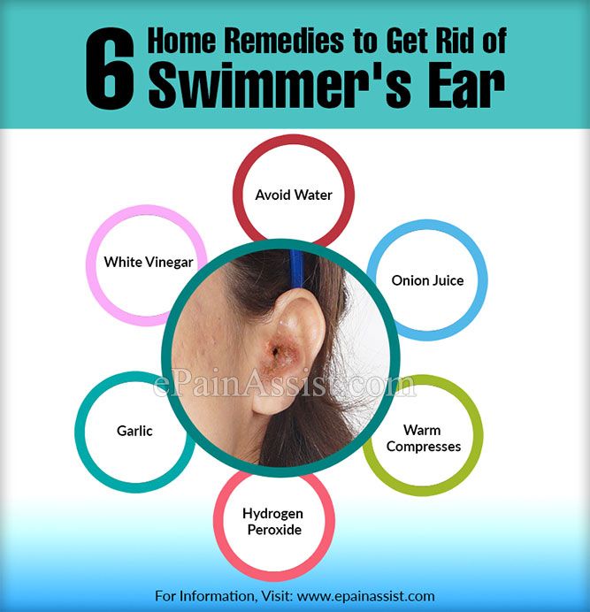 6 Home Remedies to Get Rid of Swimmer