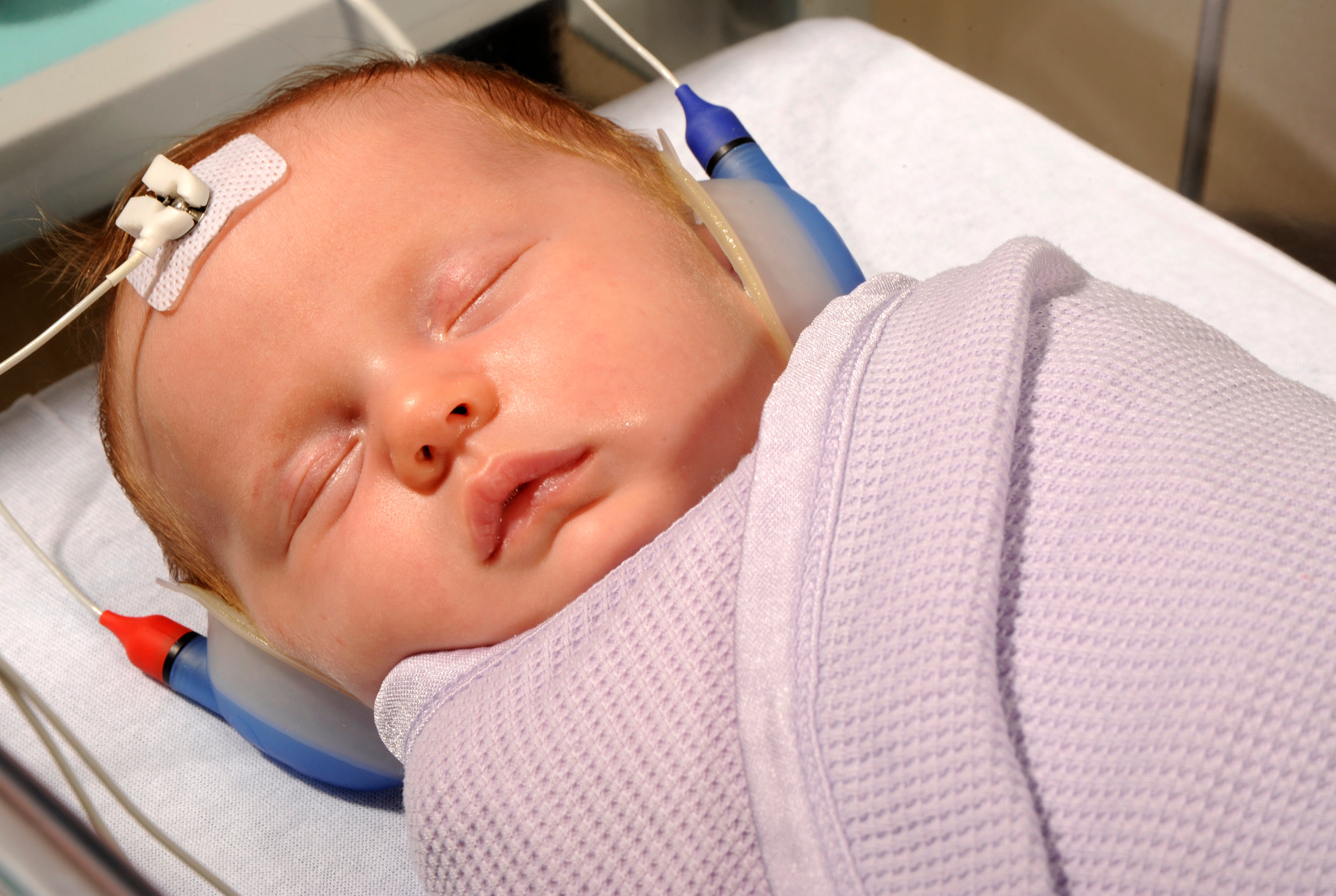 7 years of newborn hearing screening data