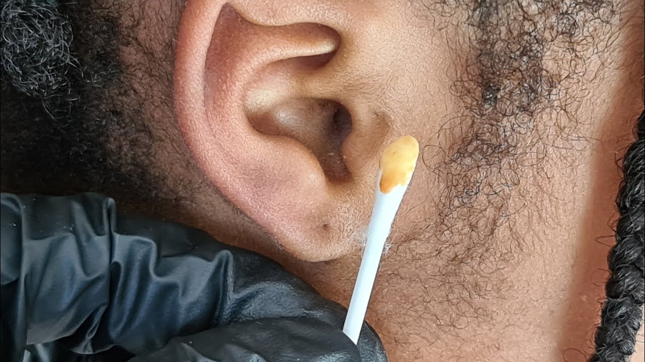 ASMR: Ear Cleaning with cotton buds
