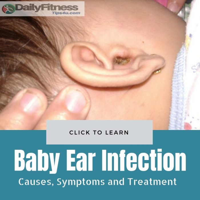 Baby Ear Infection: Causes, Picture, Symptoms, and Treatment
