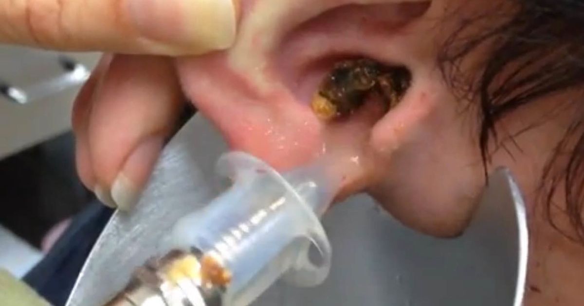 Bizarre video shows how EAR WAX is made and why