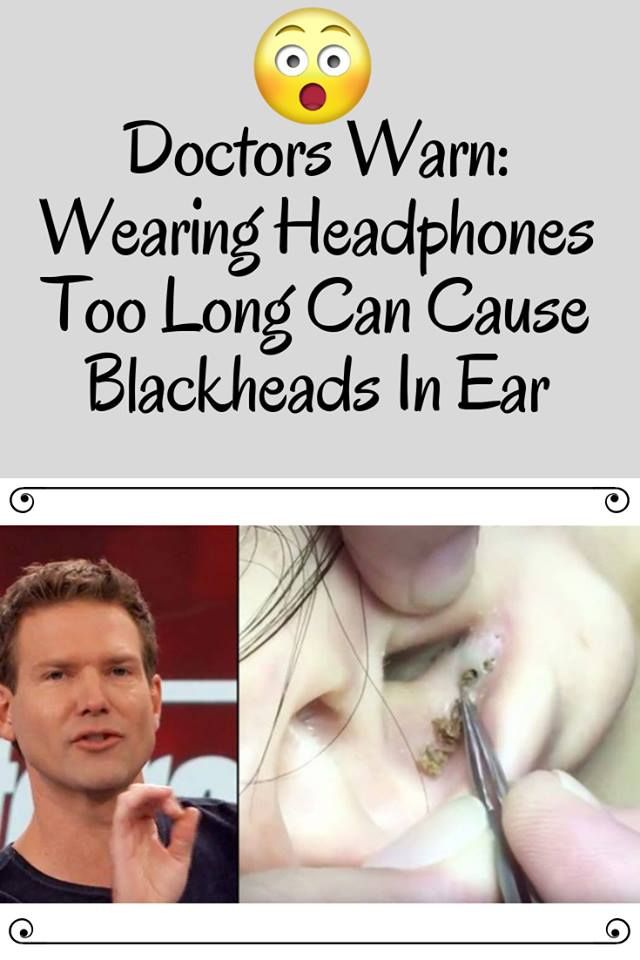 Doctors Warn: Wearing Headphones Too Long Can Cause ...