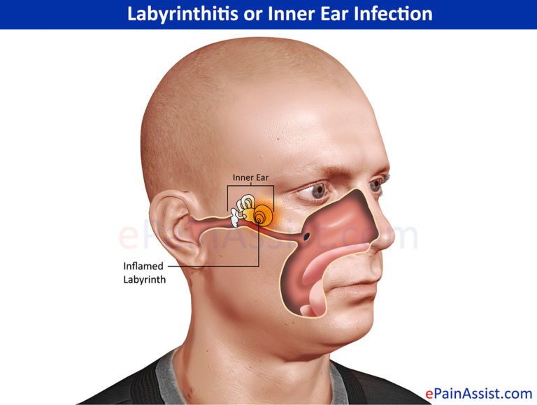 Ear infection and Treatment