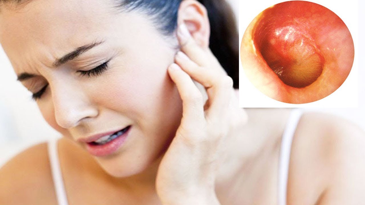 Ear Infection ~ Get Ear Infection Pain Relief Instantly ...