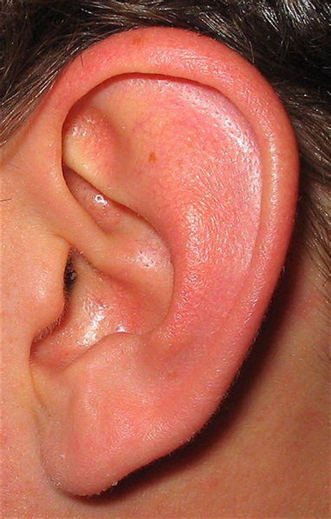 Ear lobe infection, niedrige preise, riesen