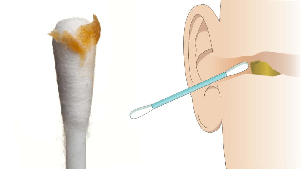 Ear Specialists Explain 6 Reasons to Stop Cleaning Ears ...