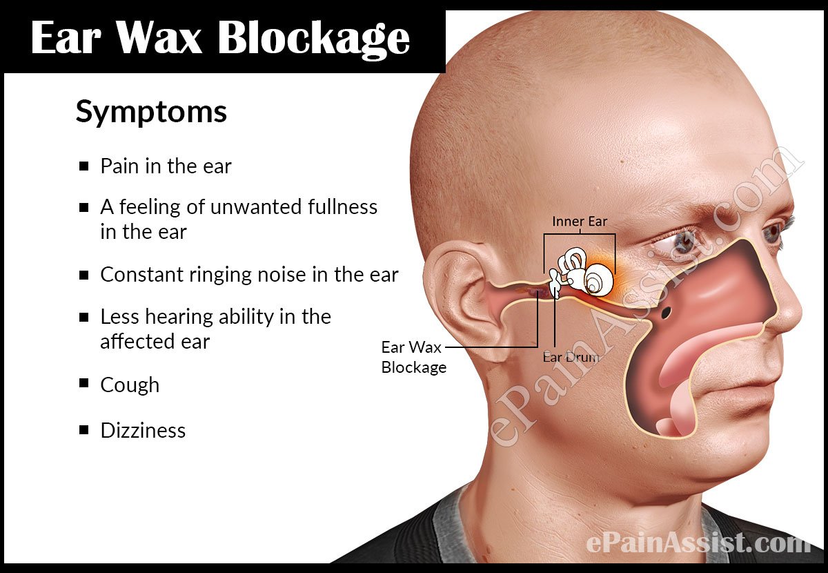 Ear Wax Blockage