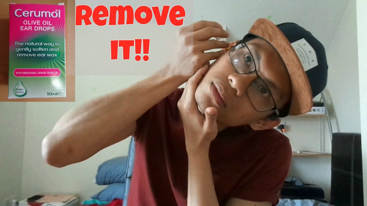 Ear Wax Removal [Easy &  Natural]