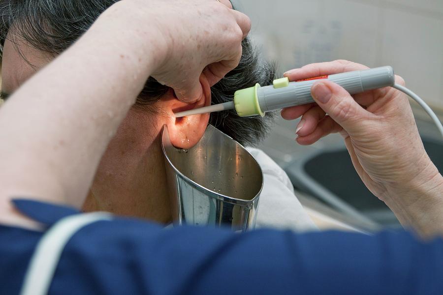 Ear Wax Removal Photograph by Life In View/science Photo ...