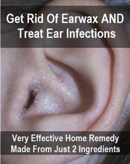 Get Rid Of Earwax And Treat Ear Infections