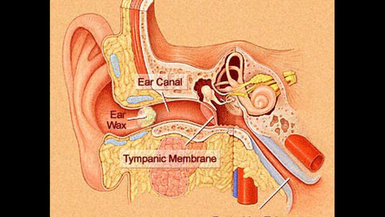 Have Earwax? Leave It Alone