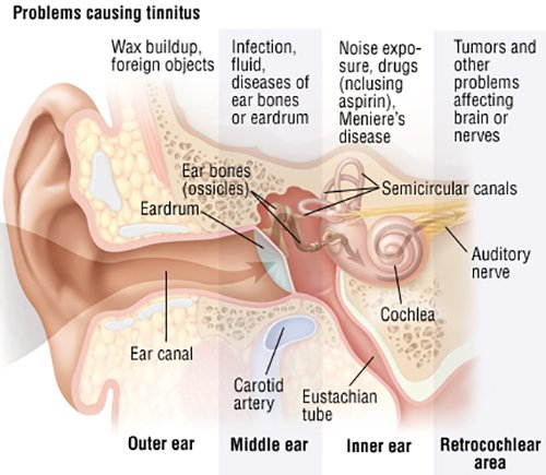 Hearing Loss &  Tinnitus Symptoms, Diagnosis &  Treatment ...
