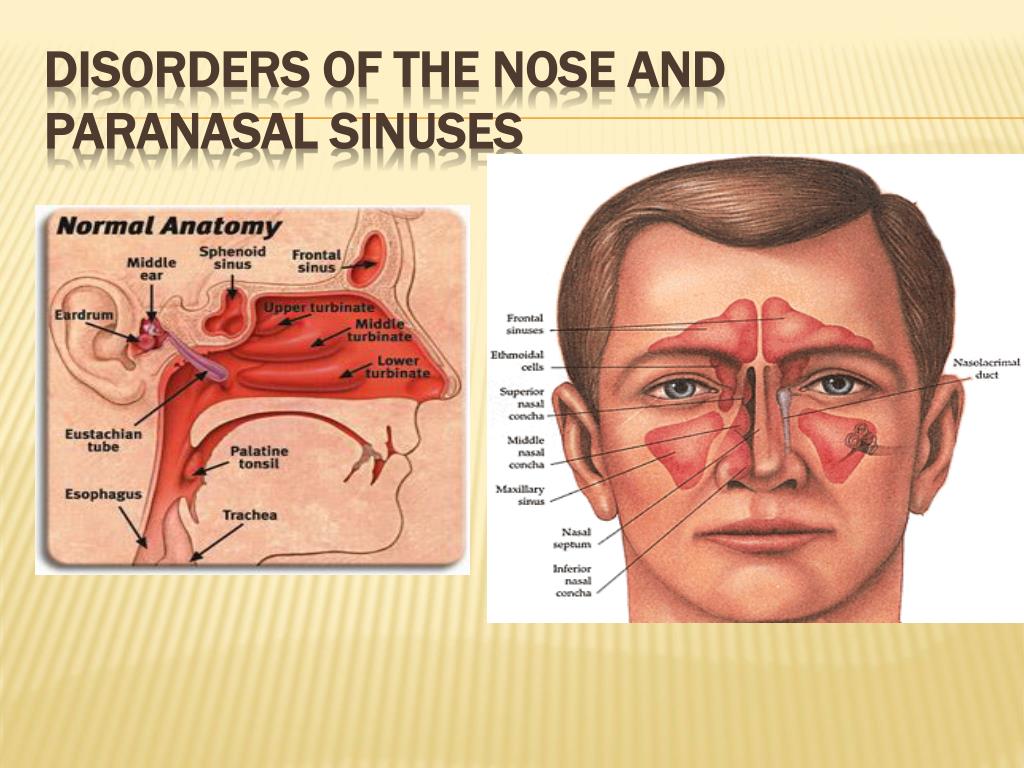 Hearing Loss Treated With Prednisone Sinusitis Nose ...