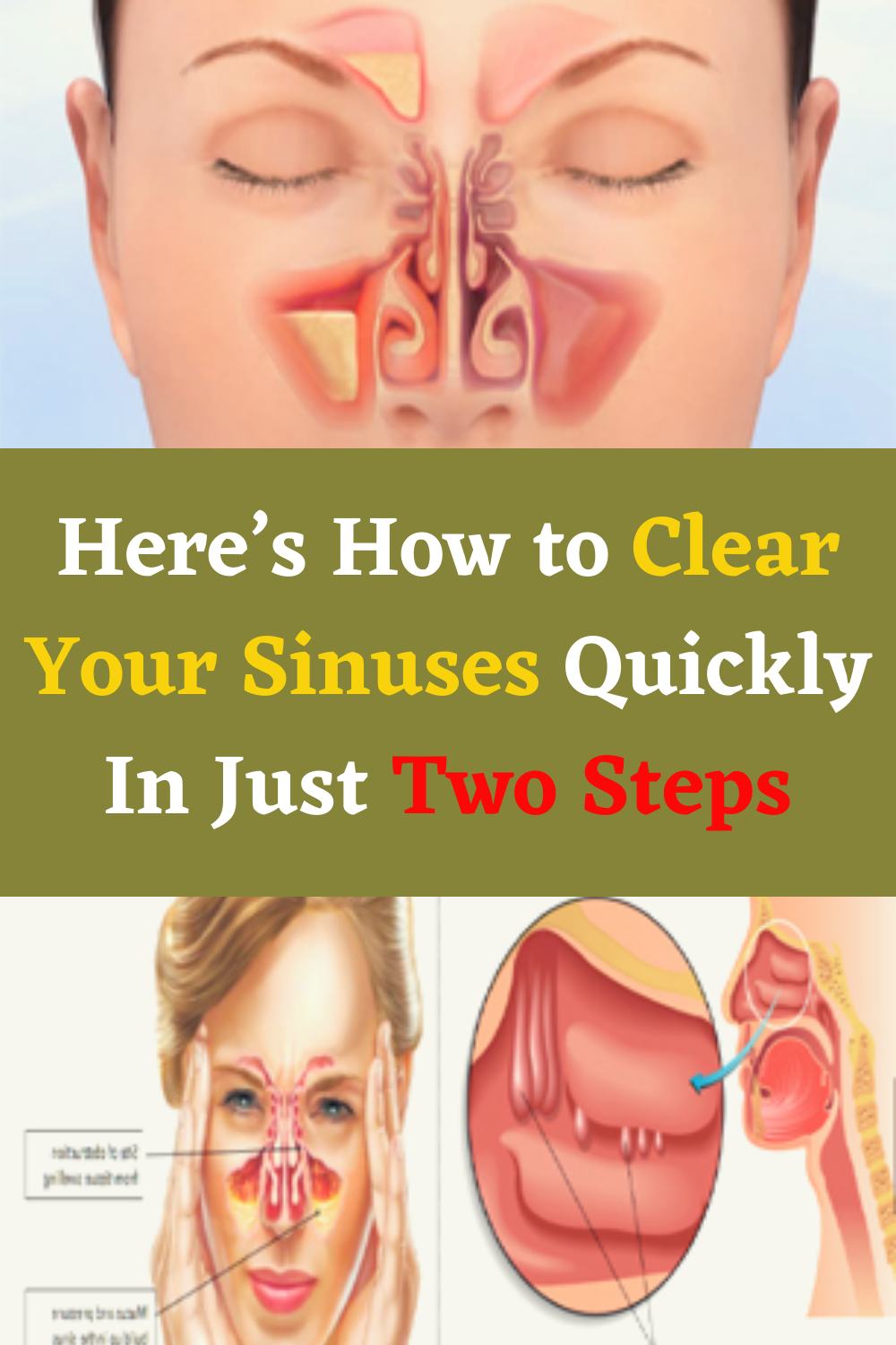 Hereâs How to Clear Your Sinuses Quickly In Just Two Steps