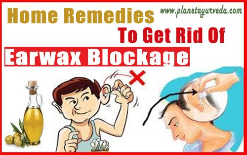 Home Remedies To Get Rid Of Earwax Blockage