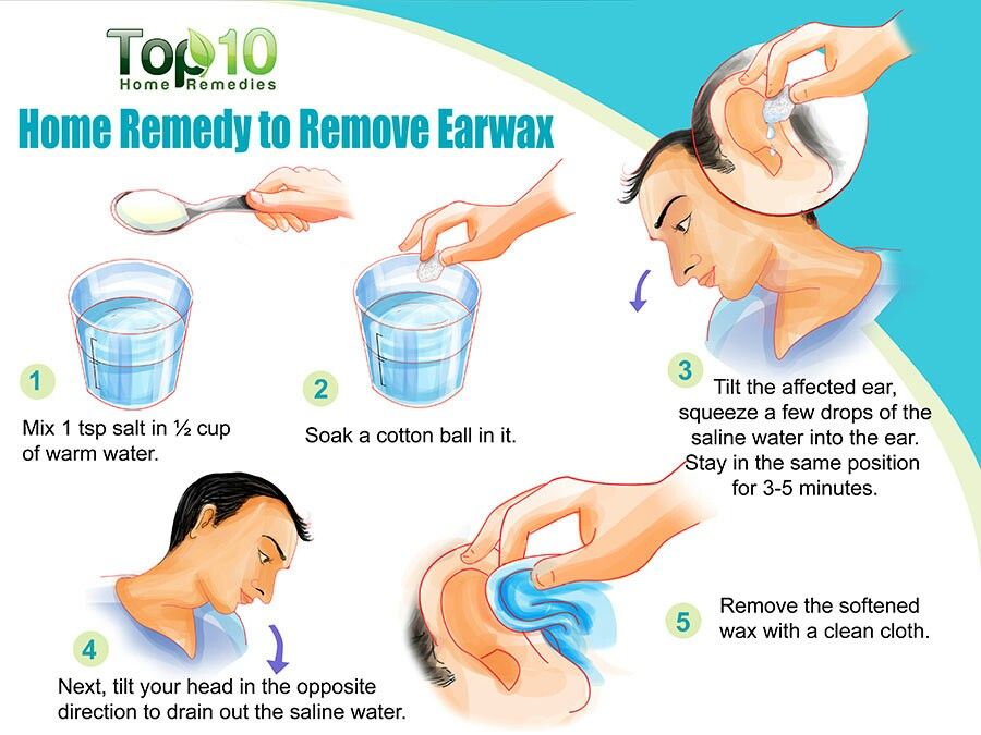 Home Remedy to Remove Earwax