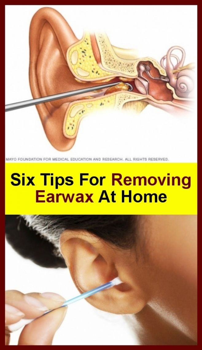 Home Six Tips To Remove Earwax in 2020