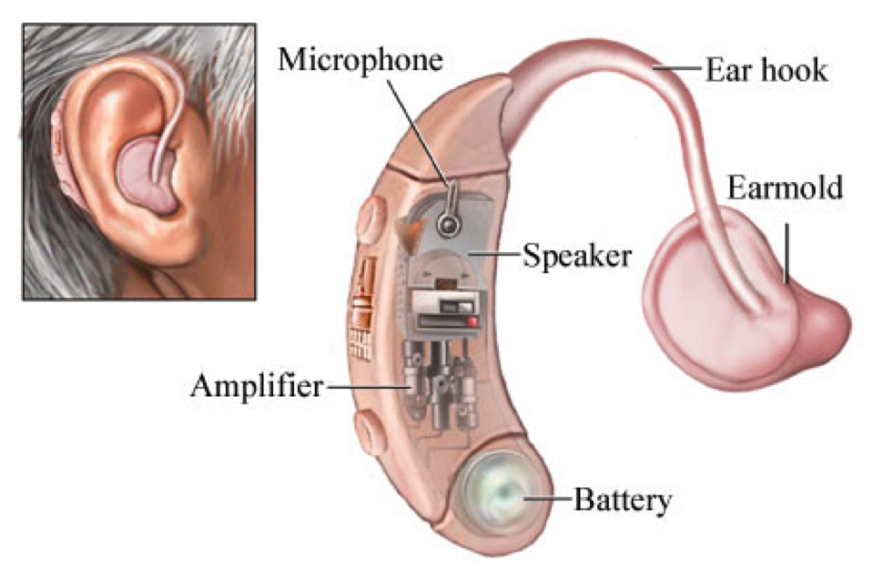 How Does A Hearing Aid Work & Timeline