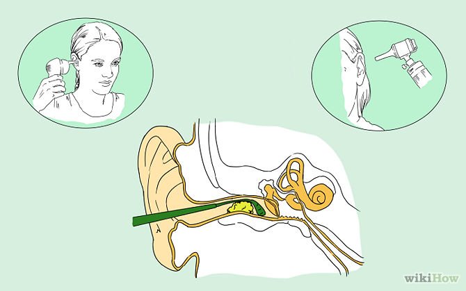 How To Clean Out Your Ears Properly &  Remove Ear Wax ...