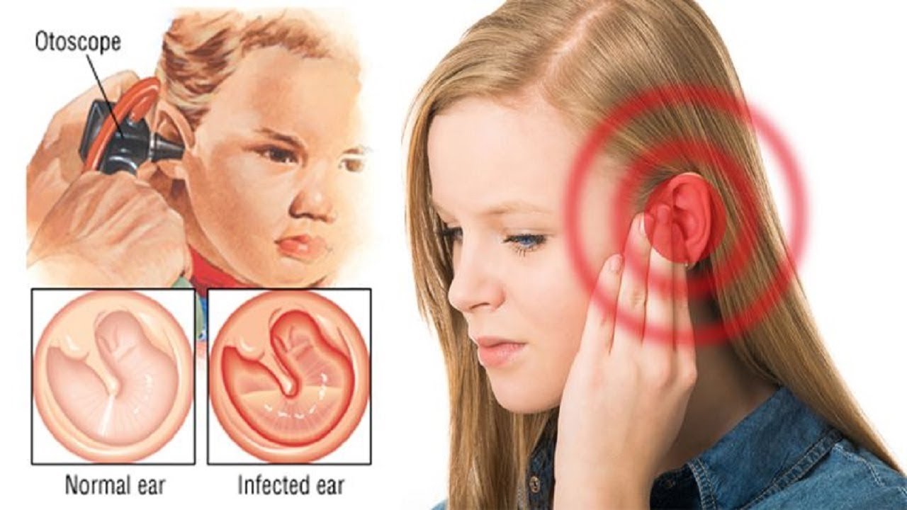 How to Get Rid of An Ear Infection Fast.