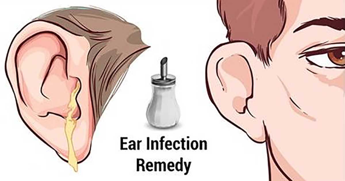 How to Get Rid of Painful Earaches and Ear Infections ...