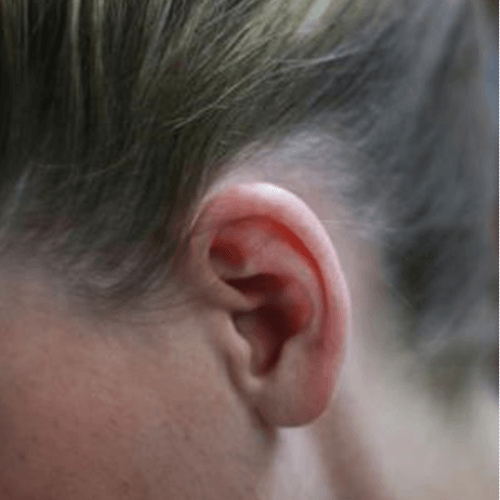 How to Get Rid of Ringing in your Ears