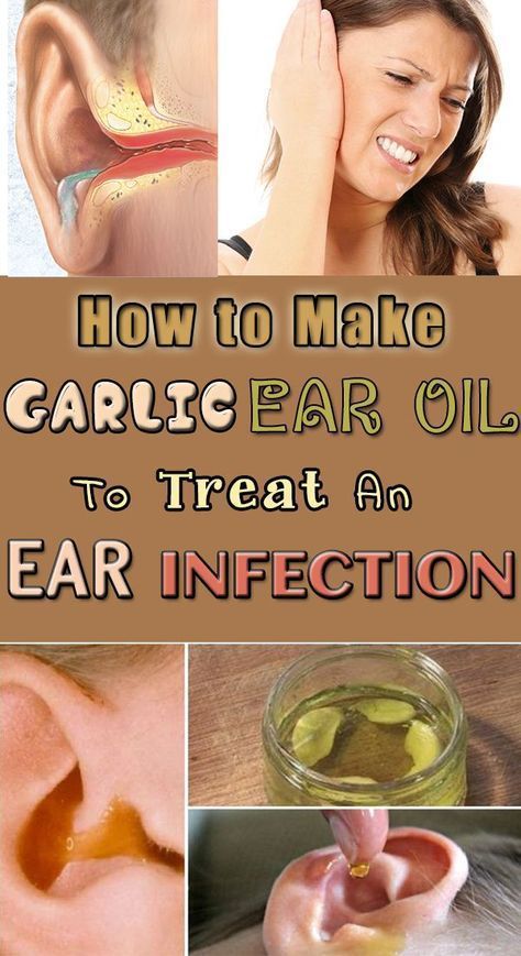 How to Make Garlic Ear Oil to Treat an Ear Infection ...