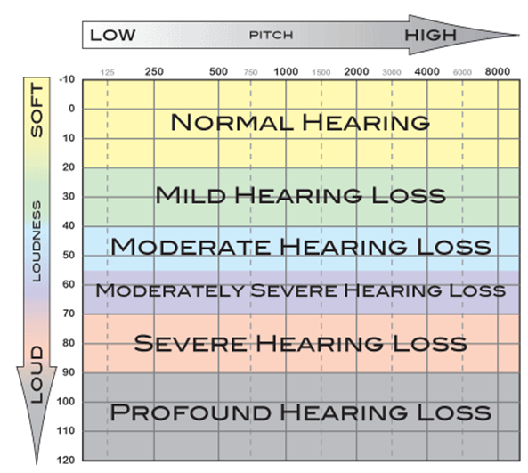 How to Read an Audiogram and Determine Degrees of Hearing Loss