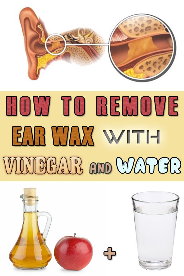 How to Remove Ear Wax with Vinegar and Water