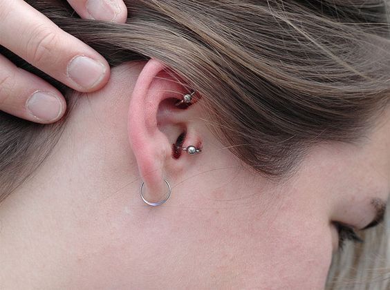 How To Treat An Infected Ear Piercing  Dermatologist ...