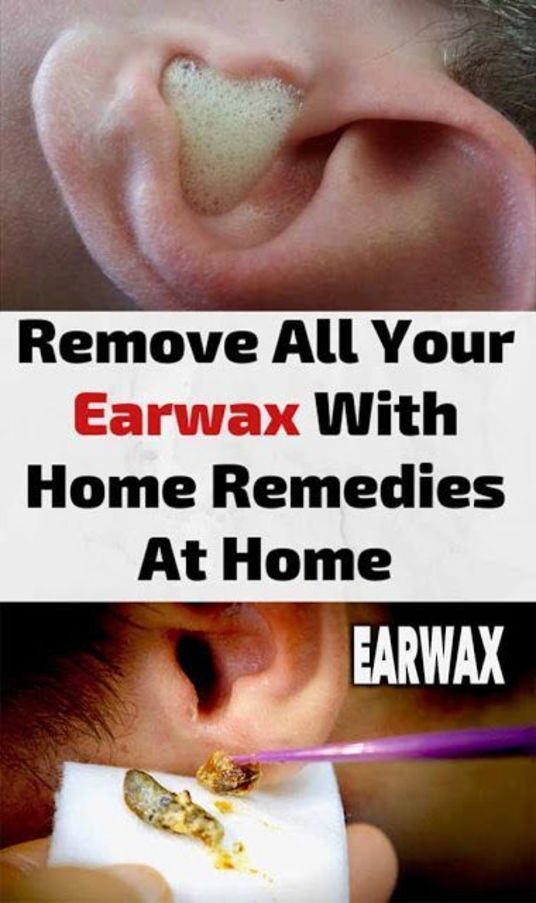 HOW TO USE HYDROGEN PEROXIDE TO REMOVE EAR WAX? in 2020