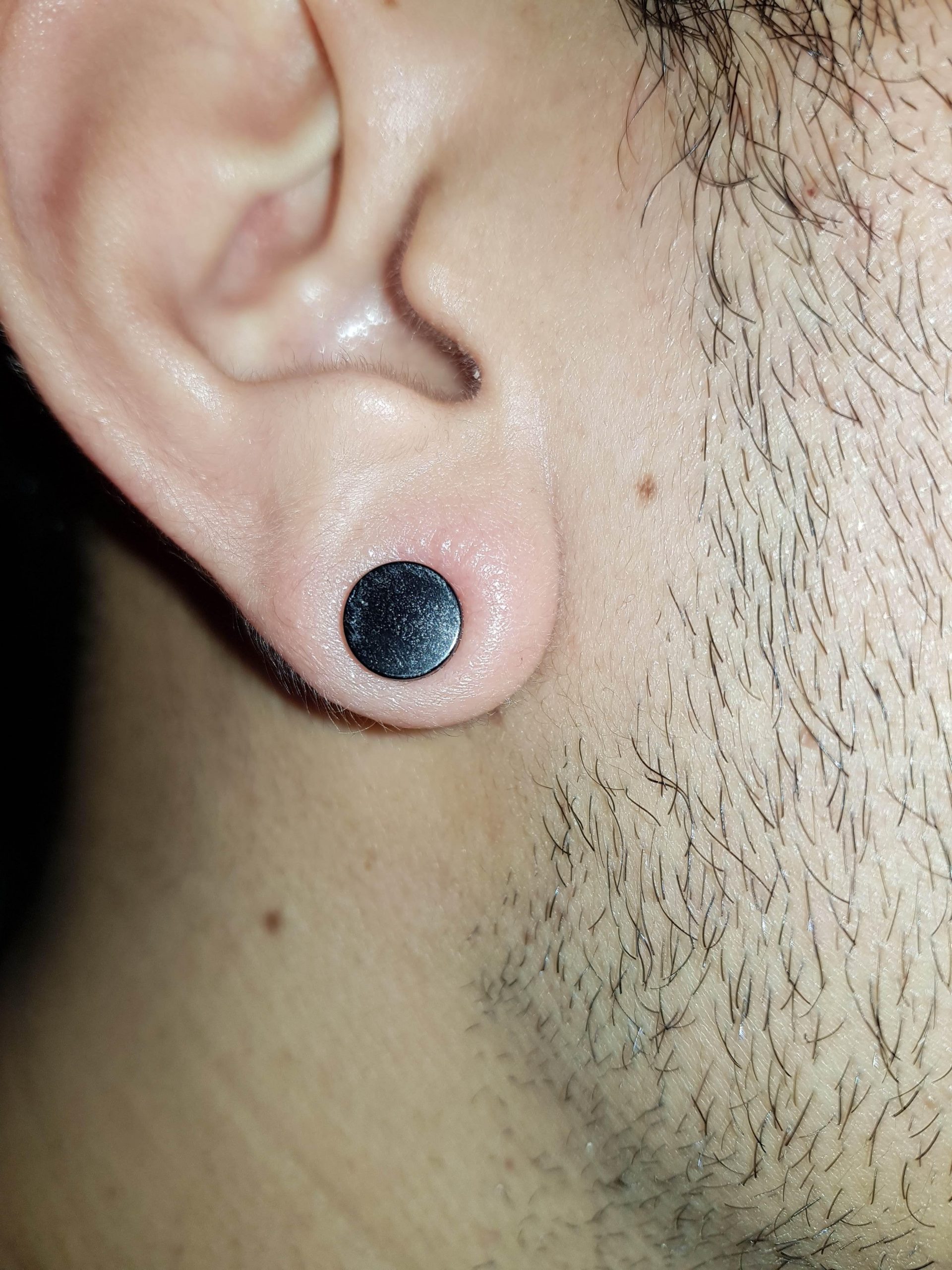 Is my ear lobe infected? : piercing