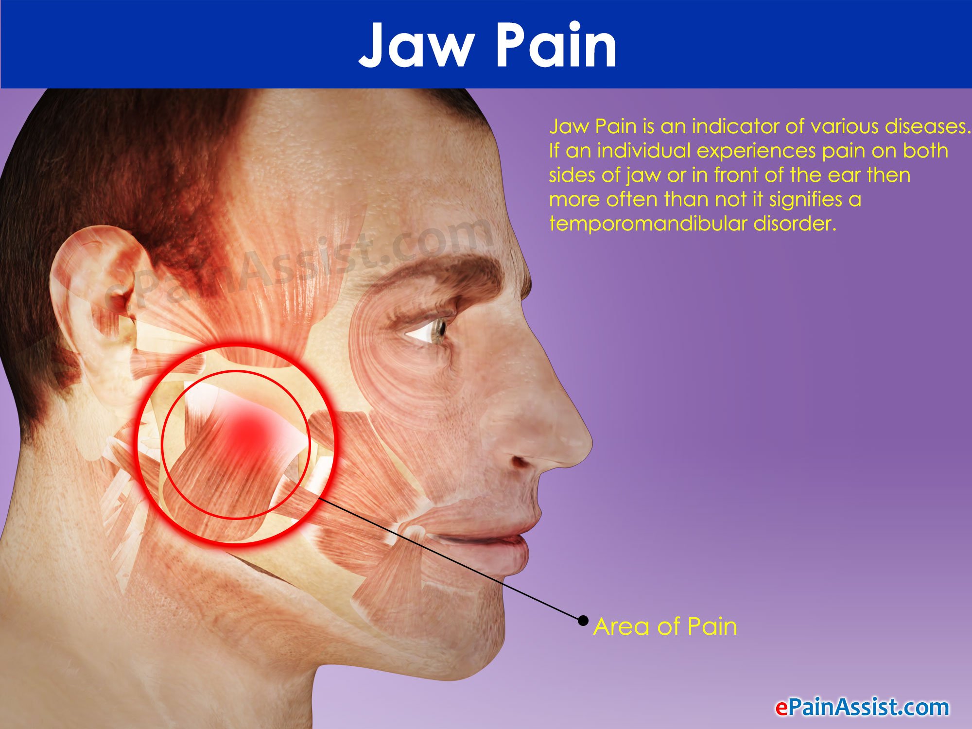 Jaw Pain: Medical Conditions That Can Cause Painful Jaw