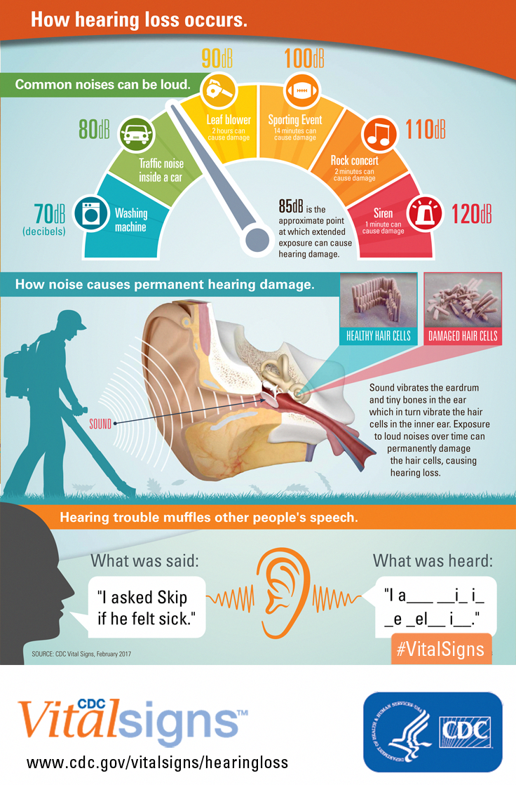 Loud noises damage hearing. Common activities in your home and ...