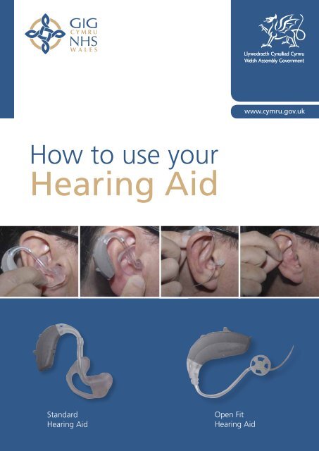 Nhs Hearing Aid Spare Parts