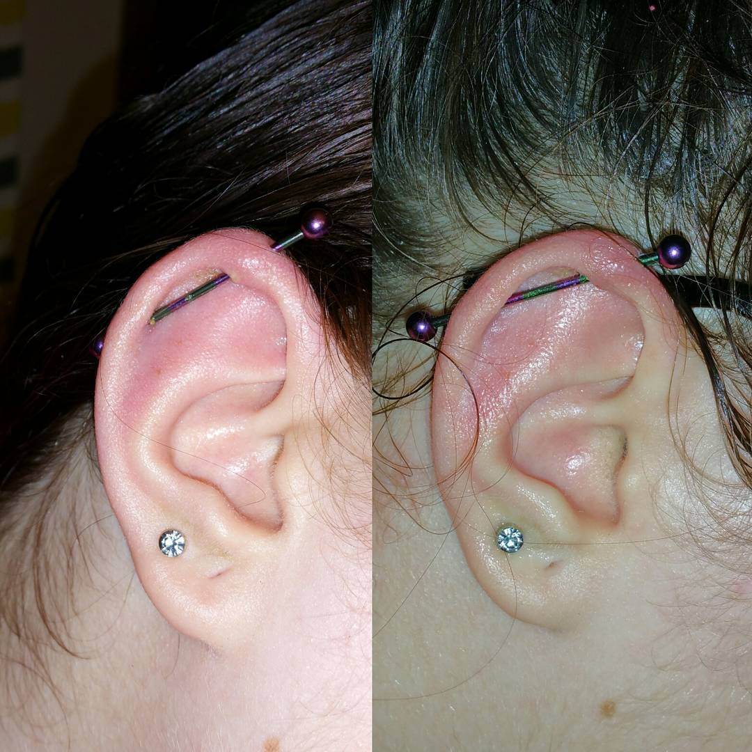 Piercing Infection: 4 Ways to HEAL FAST Infected EAR, Nose Piercing