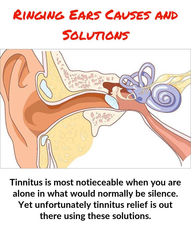 Pin on Tinnitus Causes