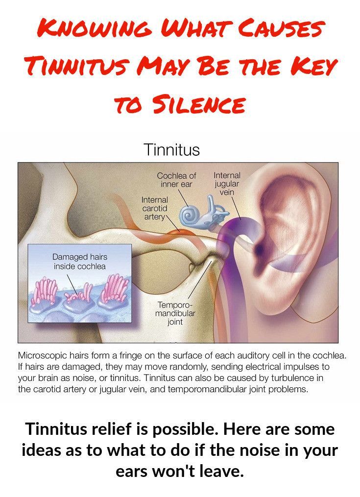 Pin on Top Tinnitus Cures