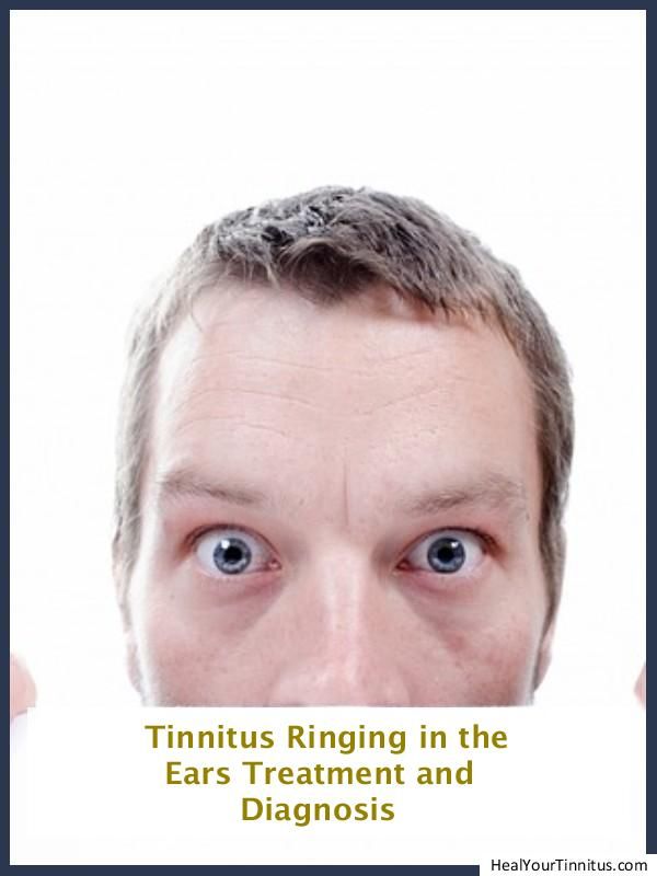 pulsatile tinnitus guidelines