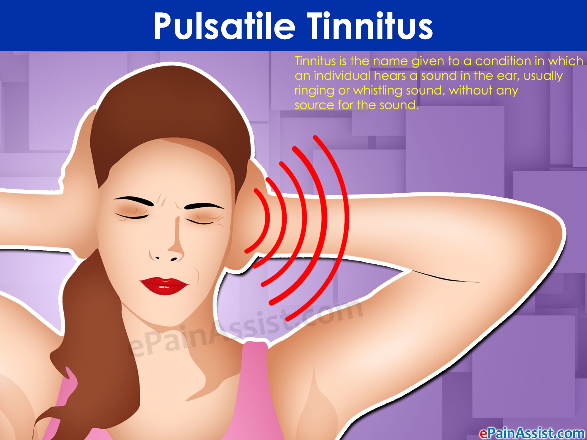 Pulsatile Tinnitus