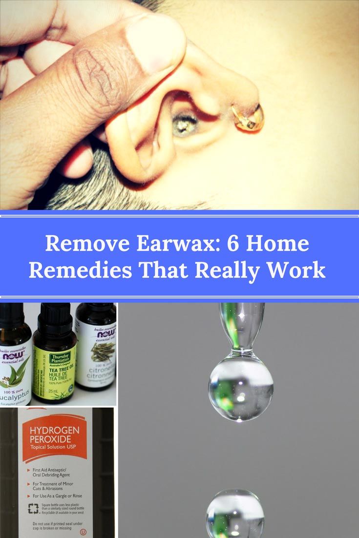 Remove Earwax: 6 Home Remedies That Really Work