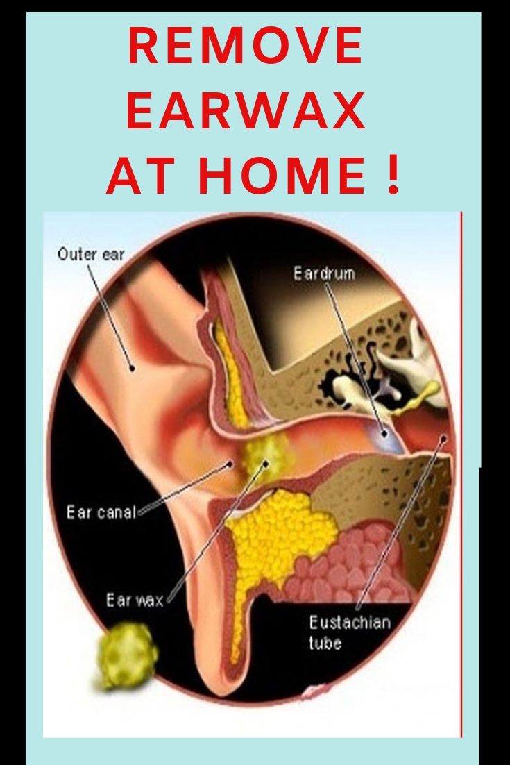 Remove Earwax At Home ! Â» Plain Live