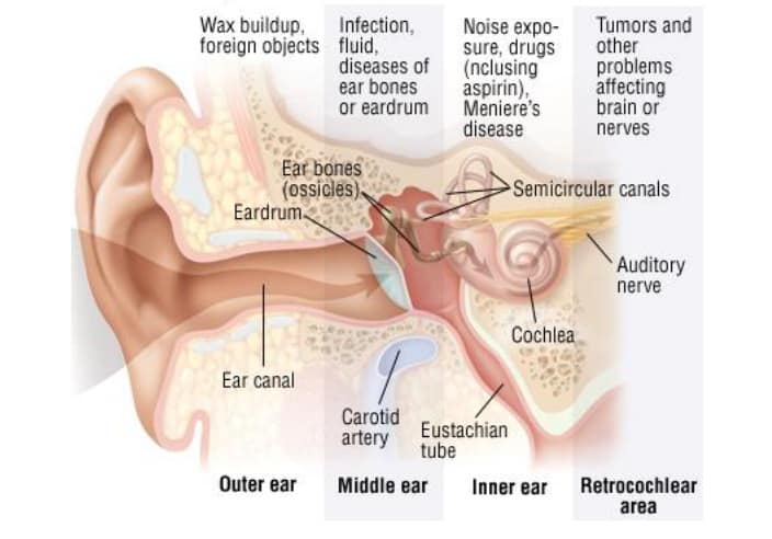 Ringing in Ears  Meaning Causes and Treatment