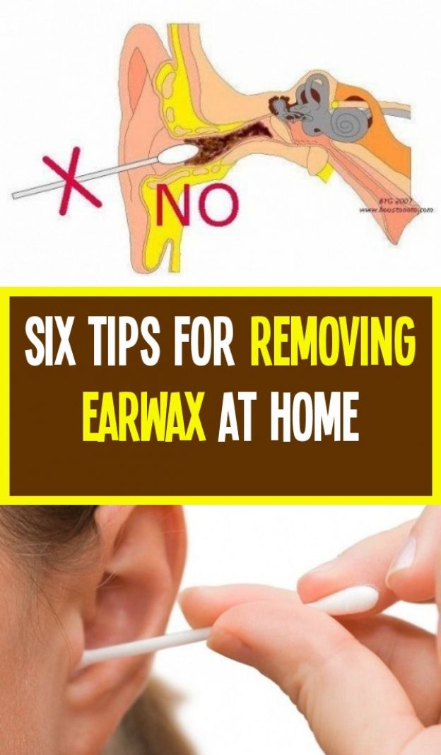 Six tips on how to remove Earwax at home in 2020