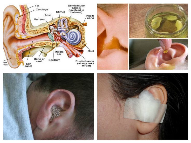 Symptoms and Treatment of Ear Infections